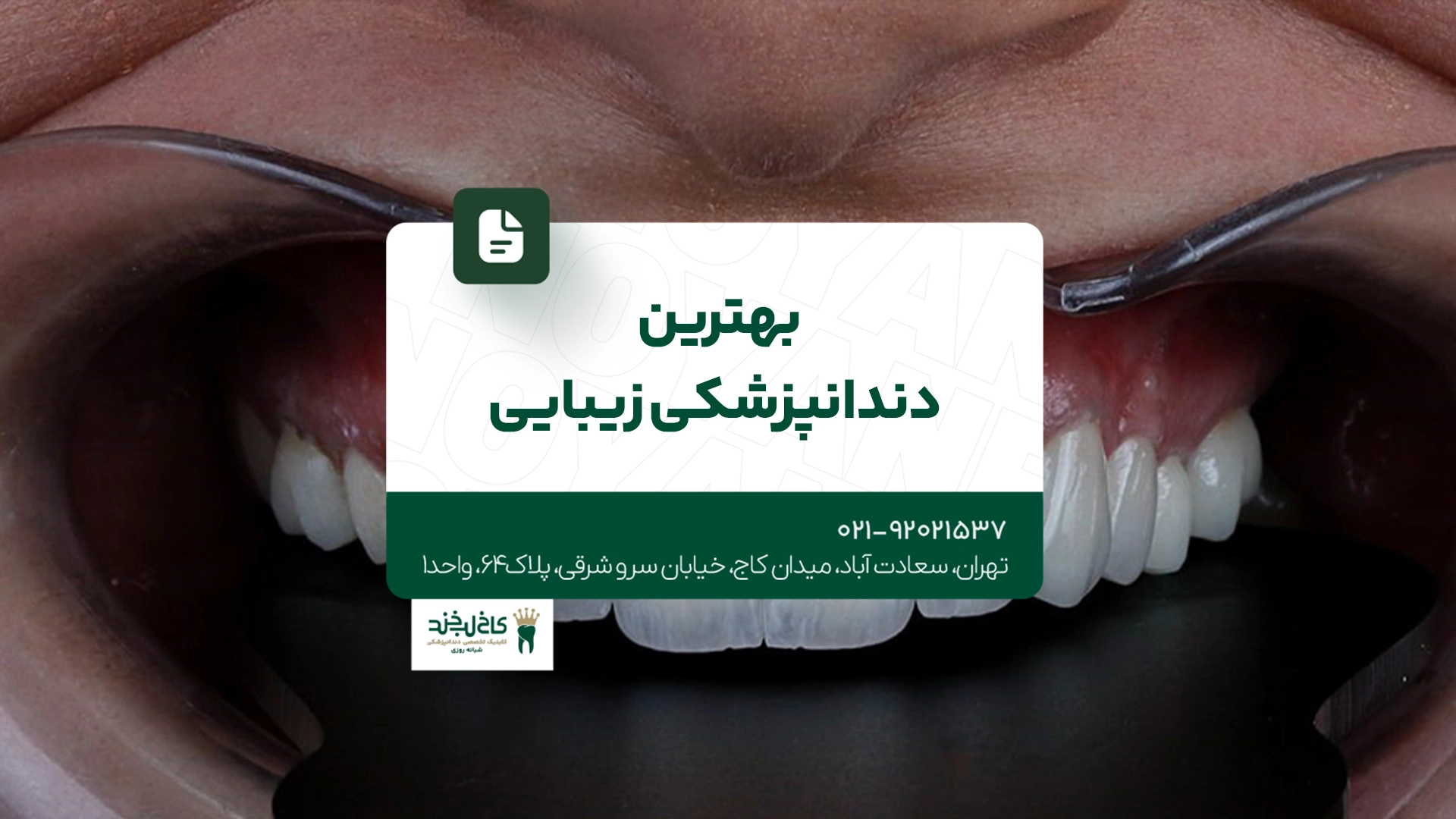 بهترین دندانپزشکی زیبایی بهترین دندانپزشکی زیبایی