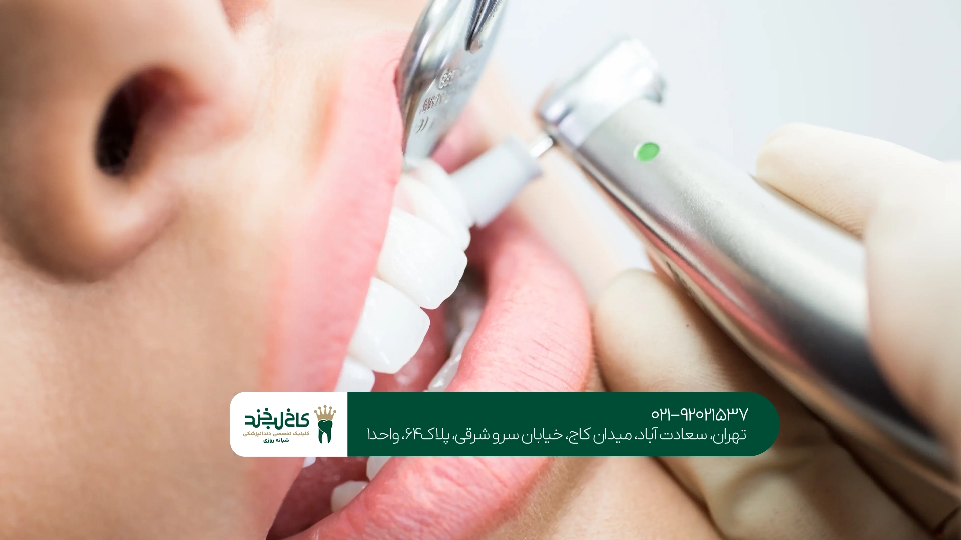 کلینیک دندانپزشکی در غرب تهران کلینیک دندانپزشکی در غرب تهران