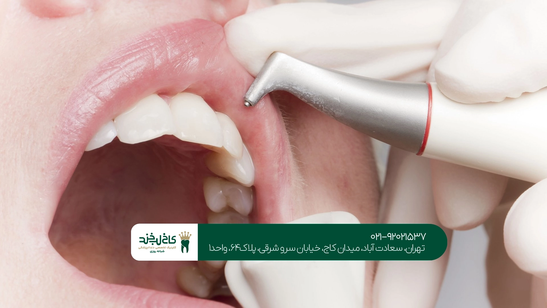 دندانپزشکی غرب تهران دندانپزشکی غرب تهران