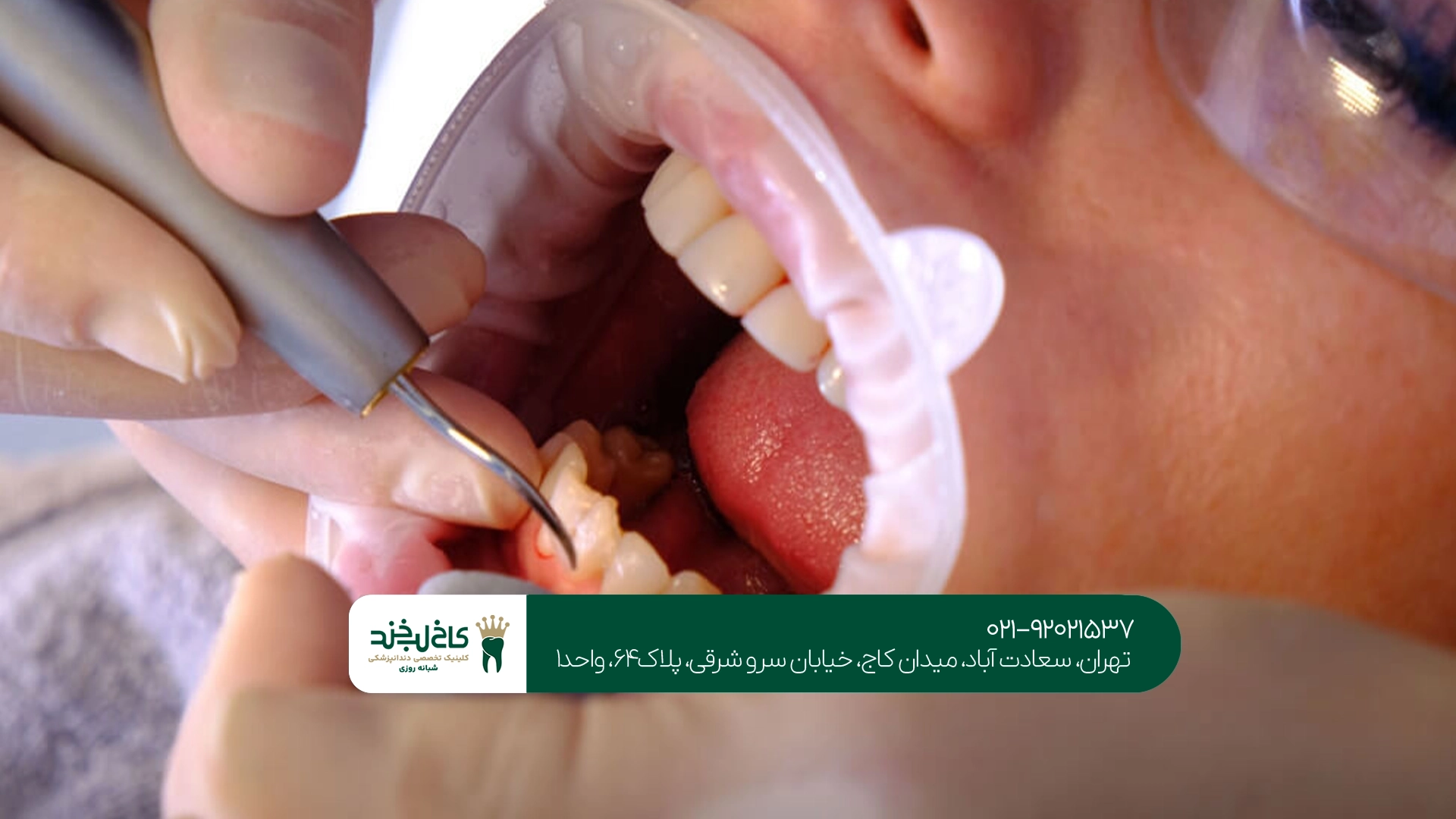 دندانپزشکی دندانپزشکی