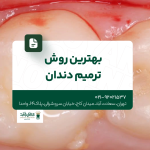 بهترین روش ترمیم دندان
