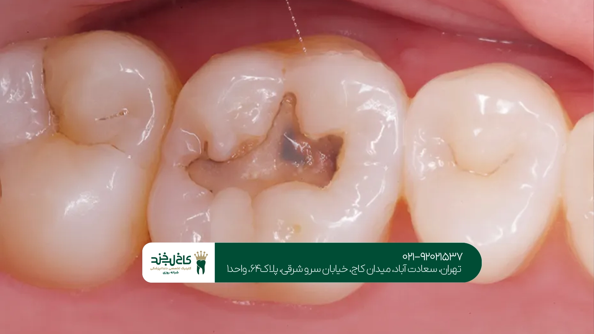 بهترین کلینیک ترمیم دندان