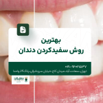 بهترین روش سفید کردن دندان