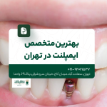 بهترین متخصص ایمپلنت در تهران