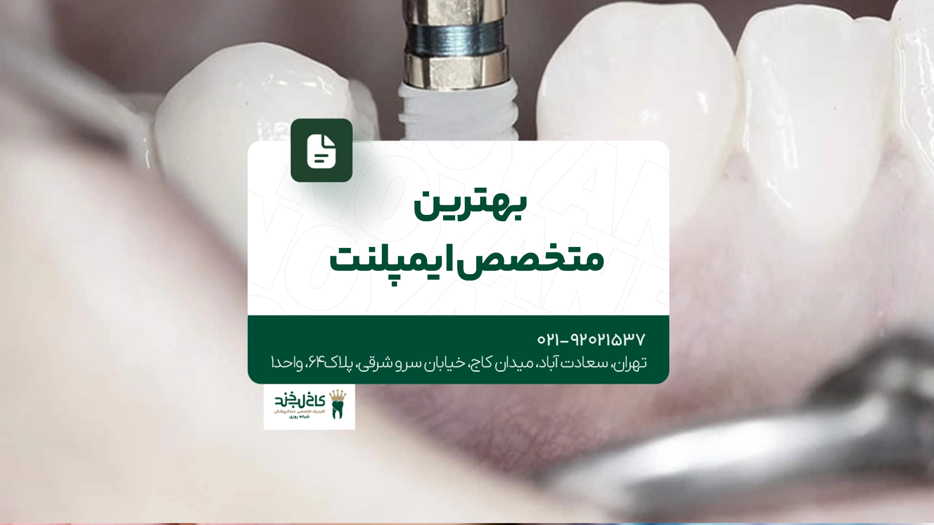 بهترین متخصص ایمپلنت