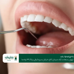 بهترین مرکز دندانپزشکی سعادت آباد