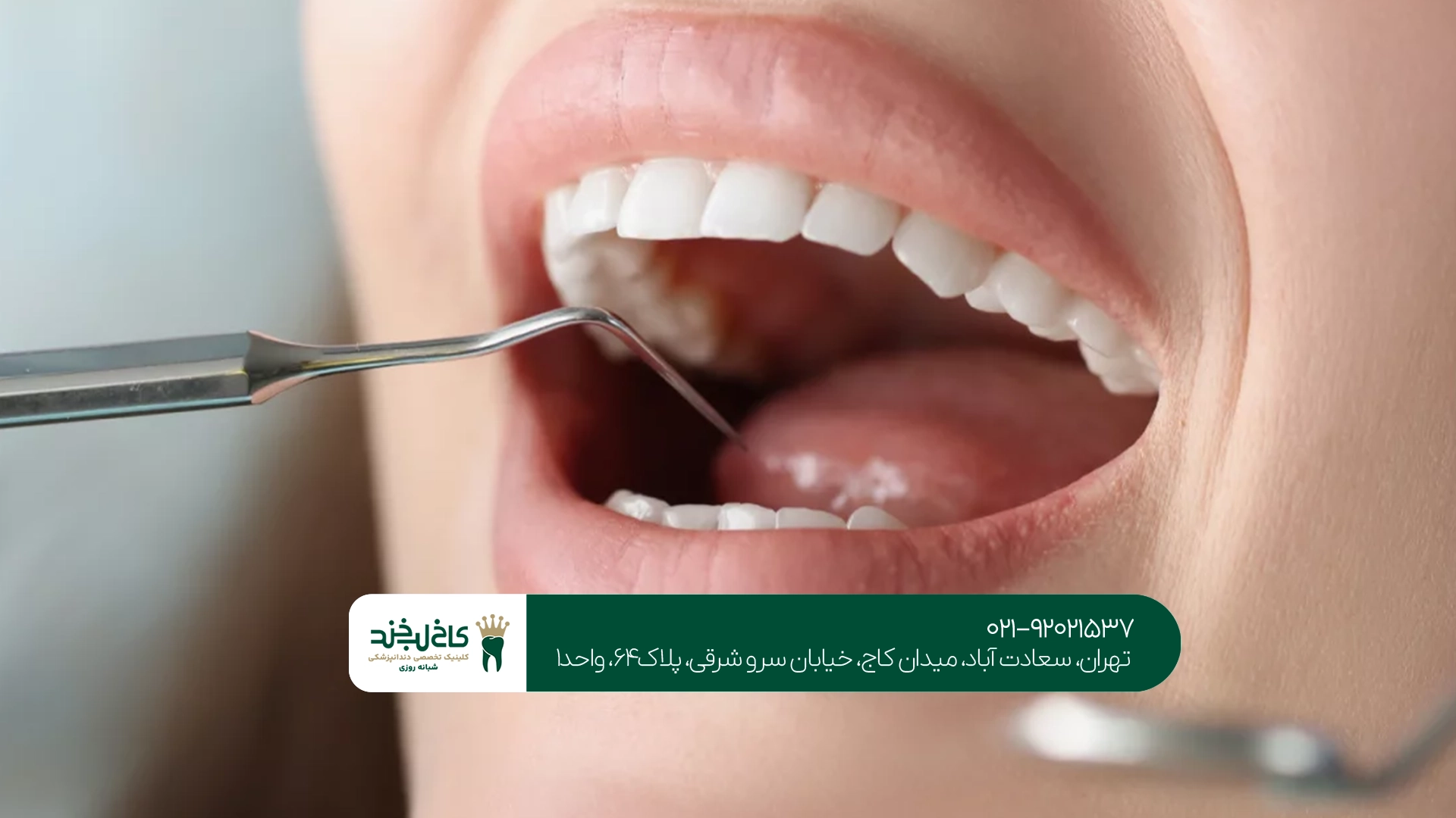 بهترین مرکز دندانپزشکی سعادت آباد