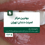 بهترین مرکز لمینت دندان تهران