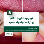 ترمیم دندان با آمالگام بهتر است یا مواد سفید
