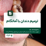 ترمیم دندان با آمالگام
