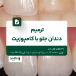 ترمیم دندان جلو با کامپوزیت