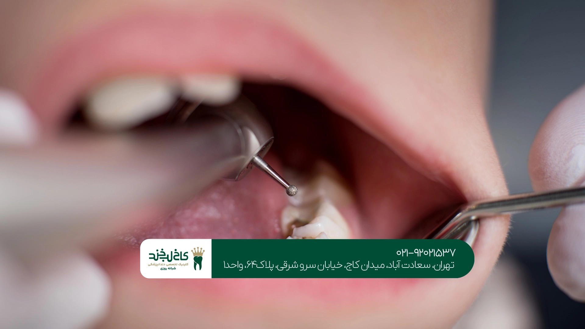 دندانپزشک متخصص ترمیم دندان کودکان