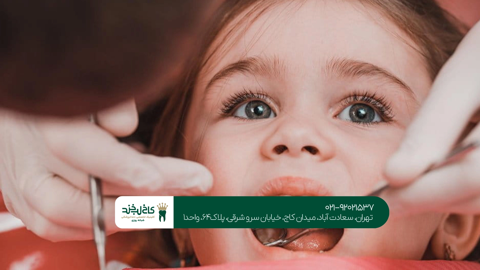 مراقبتهای بعد از ترمیم دندان کودکان