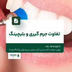 تفاوت جرم گیری و بلیچینگ
