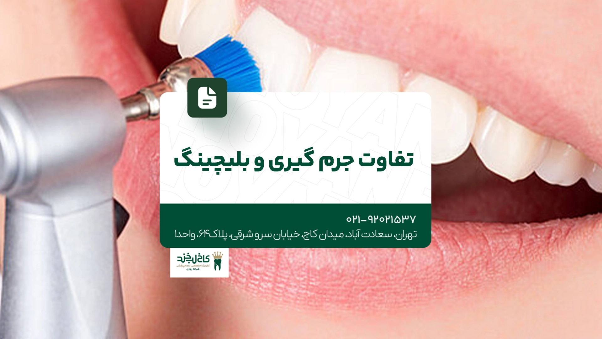 تفاوت جرم گیری و بلیچینگ تفاوت جرم گیری و بلیچینگ