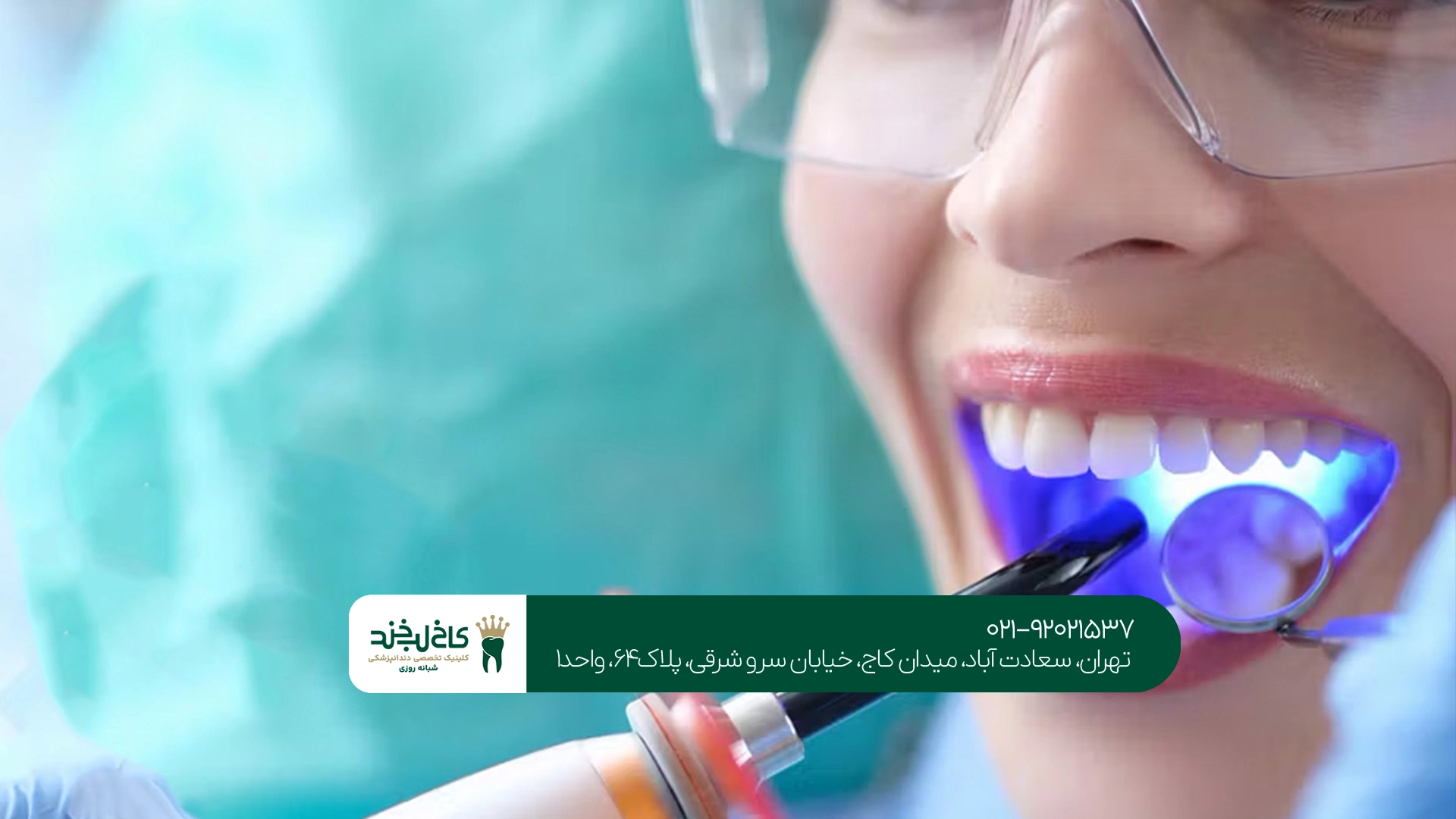 کلینیک لمینت و کامپوزیت