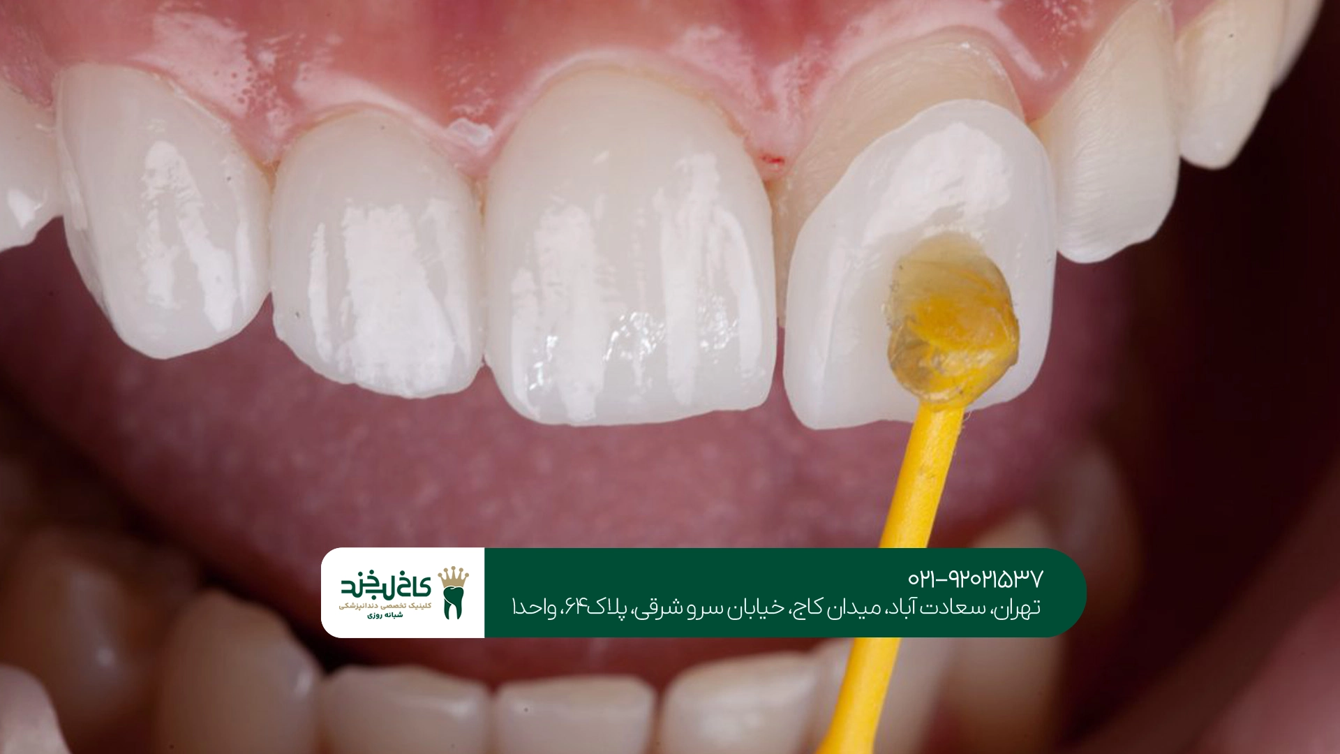 بهترین مرکز لمینت و کامپوزیت
