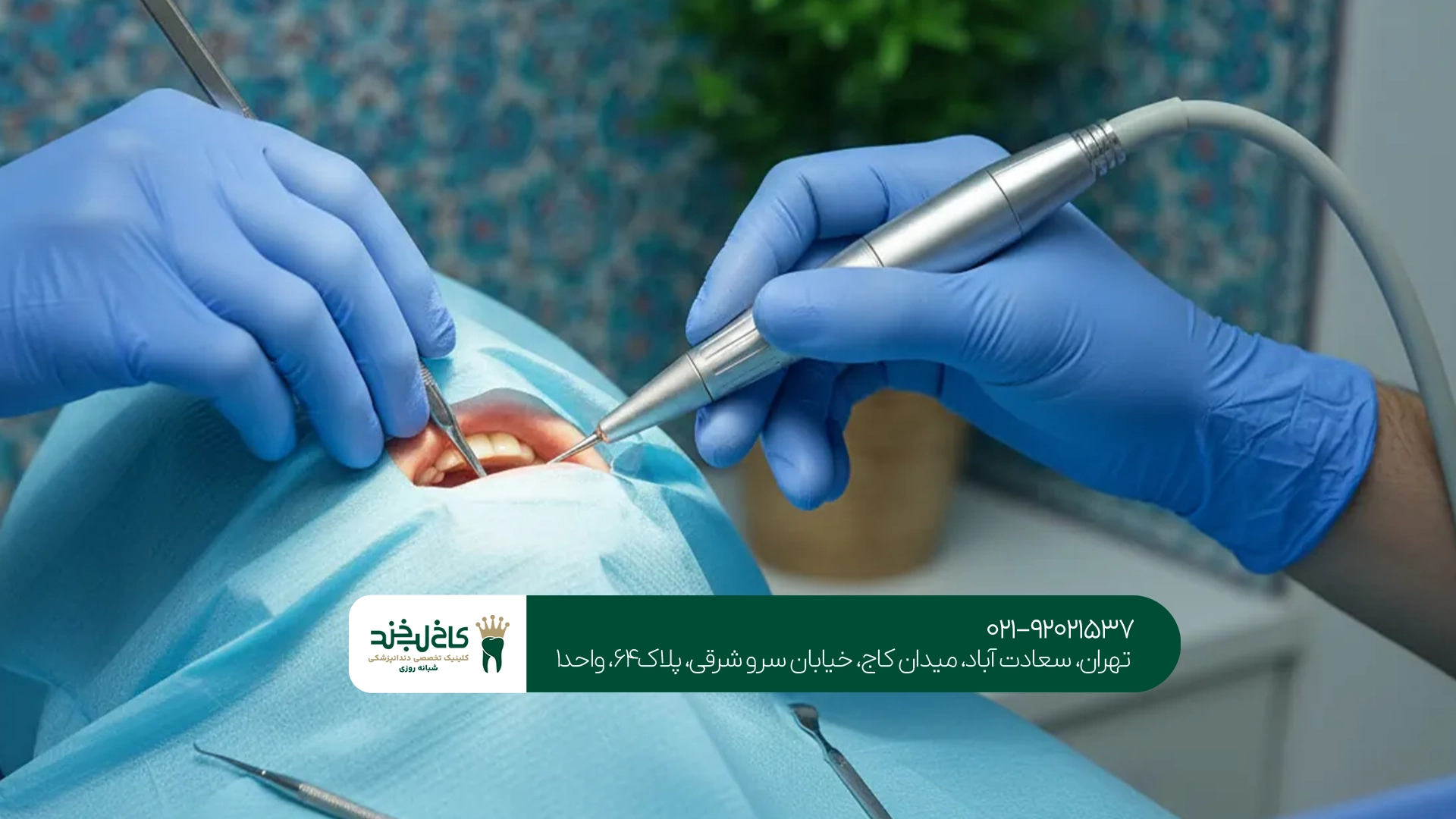 عوارض احتمالی جراحی دندان نهفته