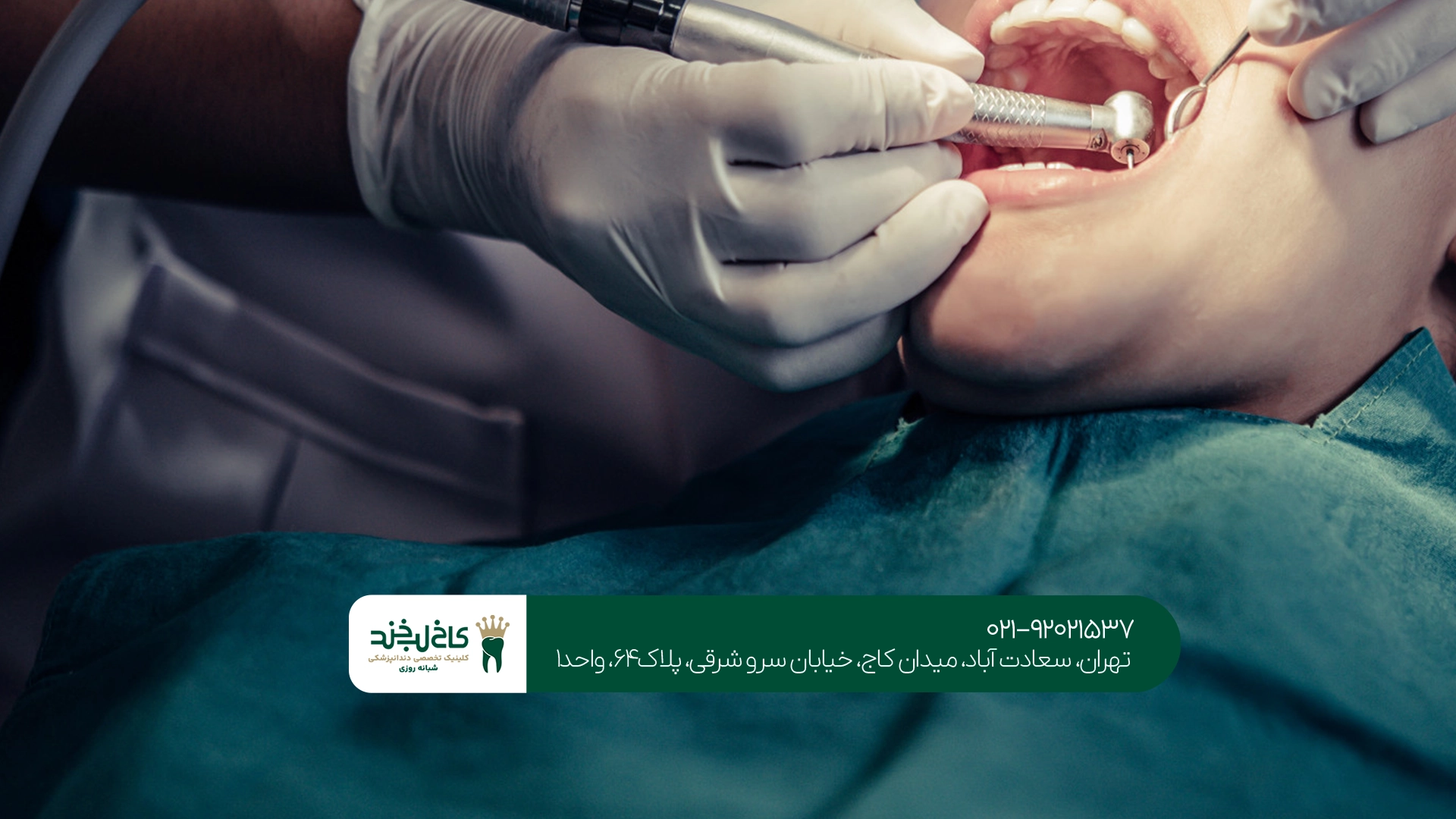 جراحی دندان عقل نهفته در تهران