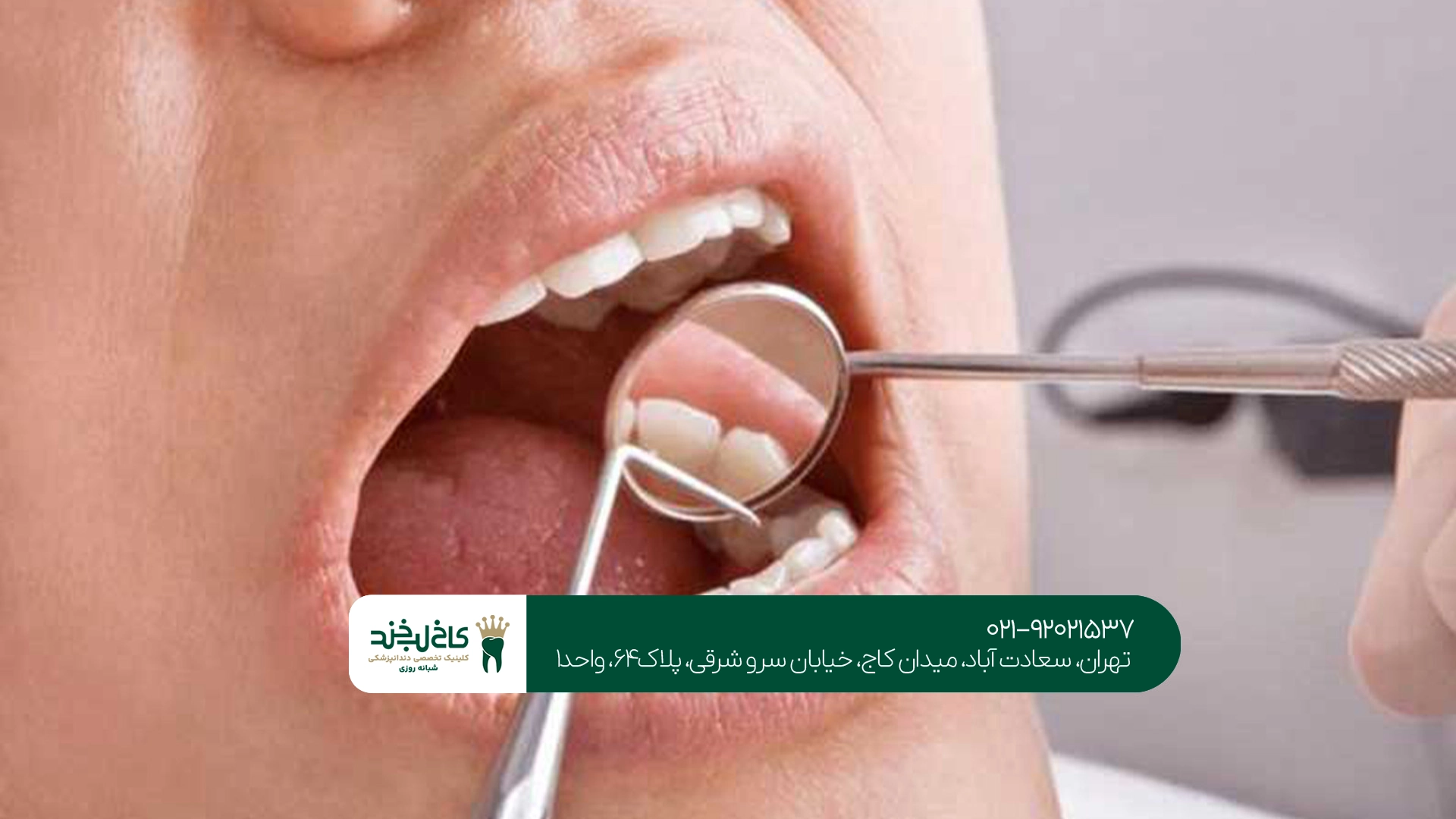 جراحی ریشه دندان در تهران