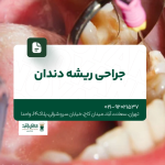 جراحی ریشه دندان