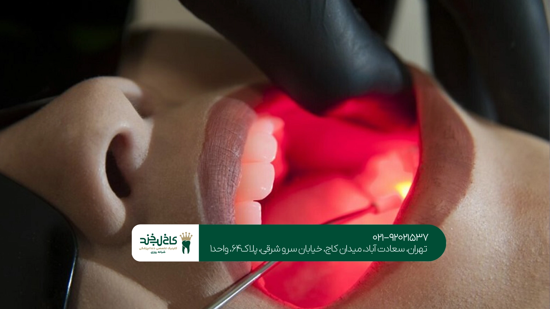 چه افرادی کاندیدای مناسب جراحی لثه با لیزر هستند؟