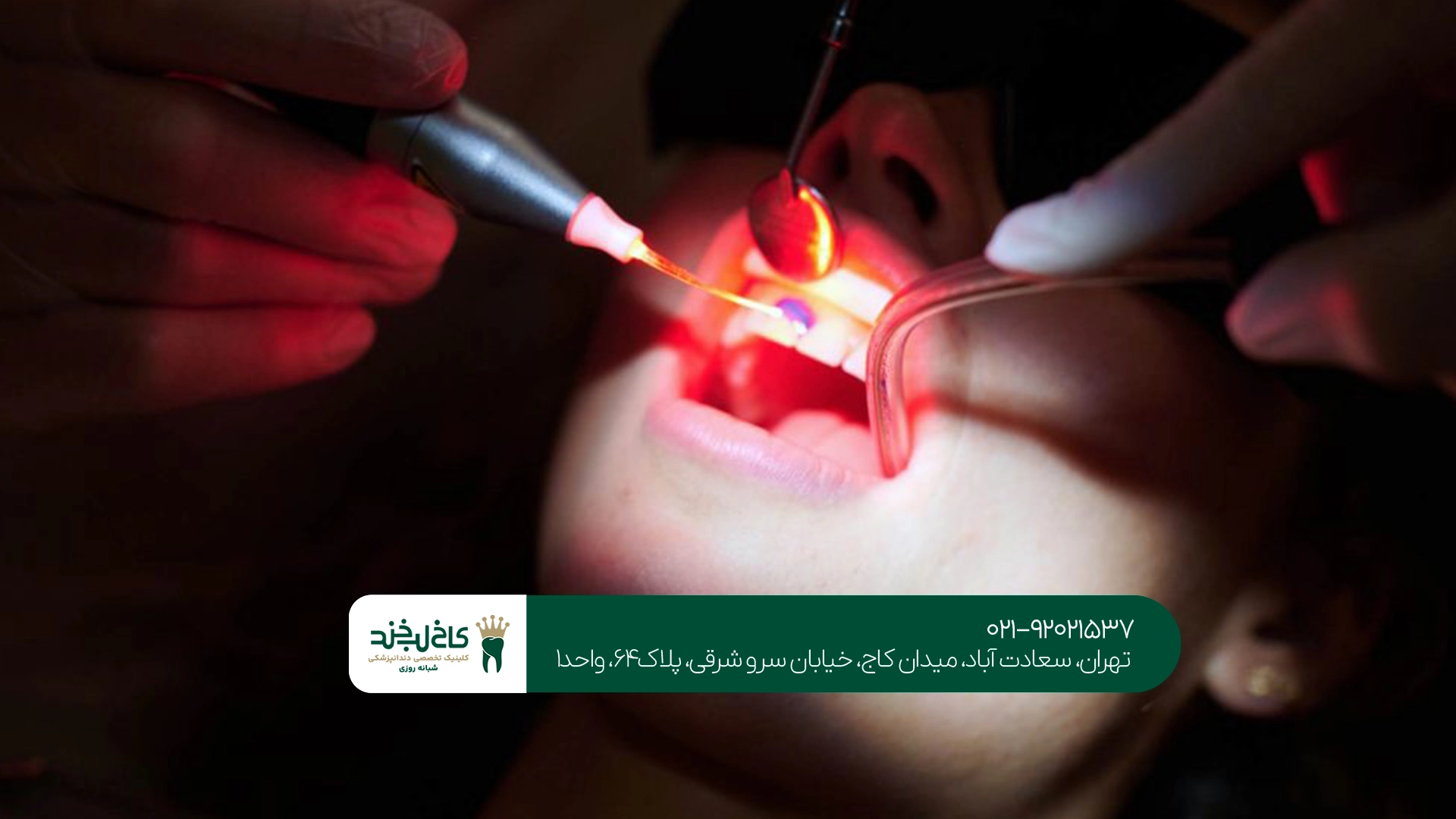 جراحی لثه با لیزر در تهران