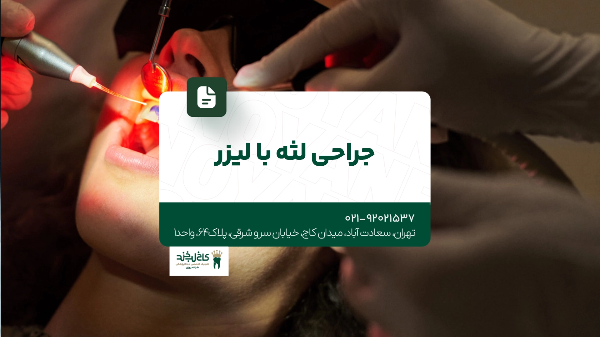جراحی لثه با لیزر