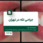 جراحی لثه در تهران