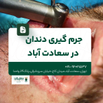 جرم گیری دندان در سعادت آباد
