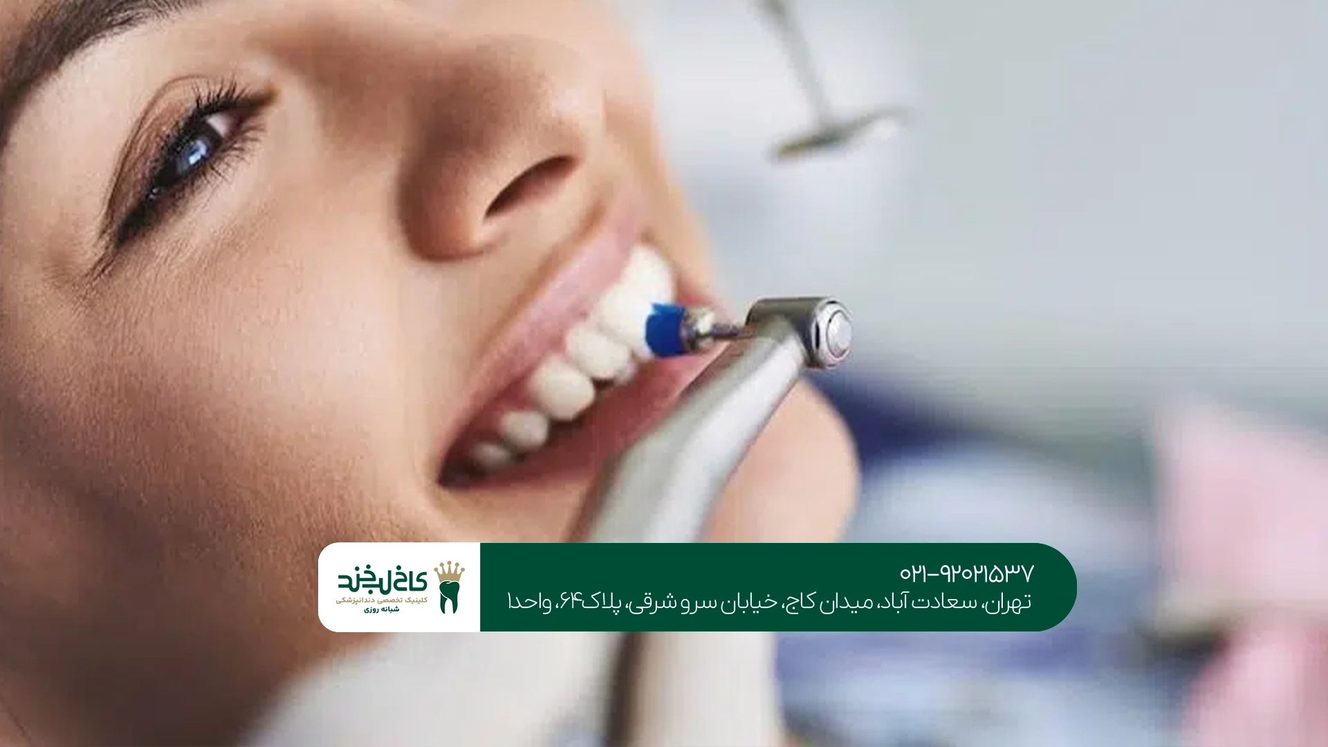 بهترین مرکز جرم گیری دندان بهترین مرکز جرم گیری دندان
