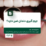 جرم گیری دندان ضرر دارد
