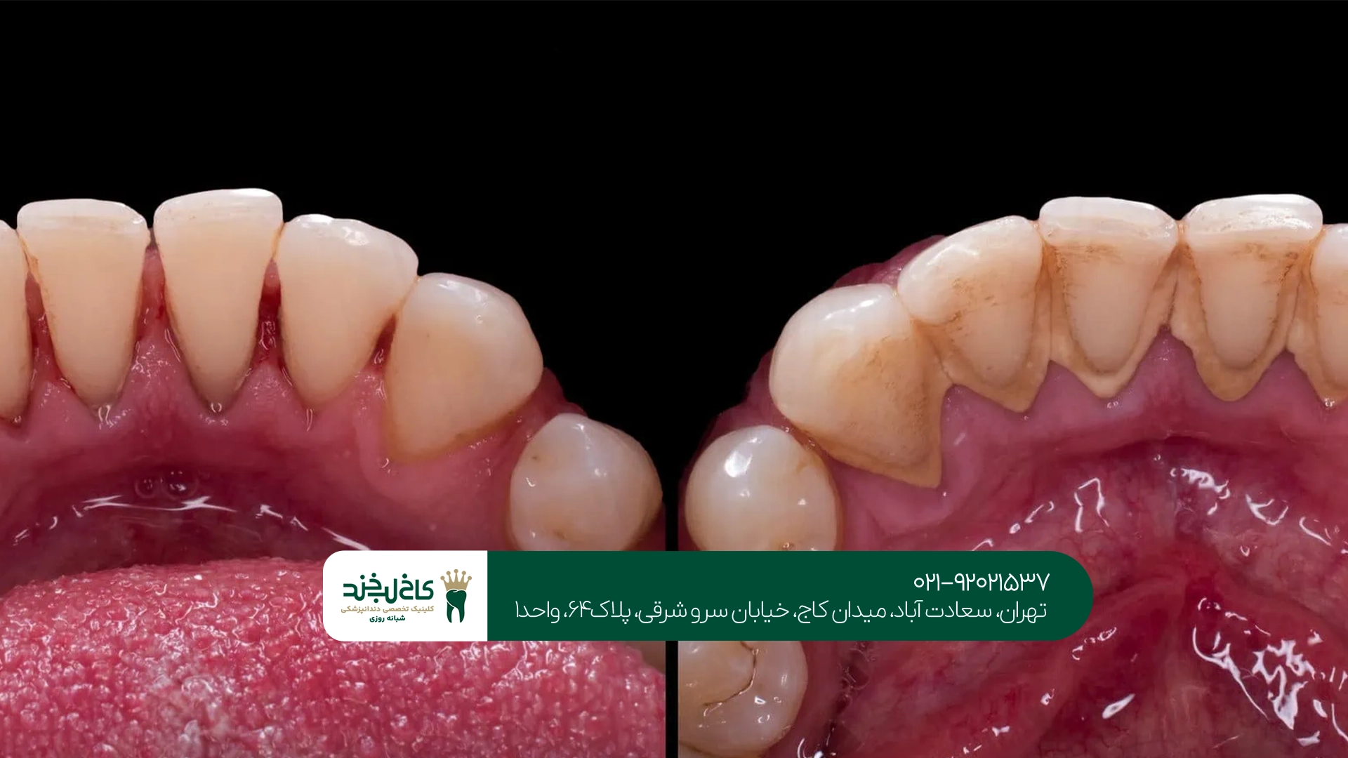 متخصص درمان بیماری لثه