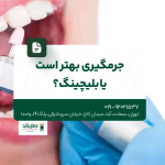 جرمگیری بهتر است یا بلچینگ