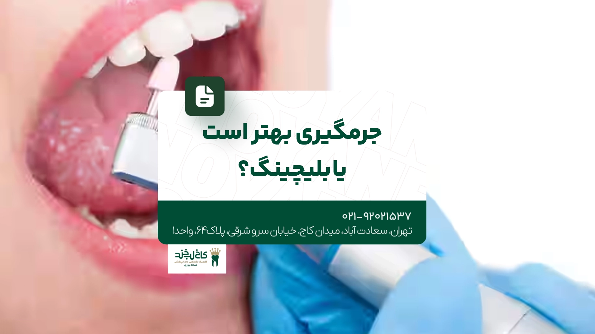 جرمگیری بهتر است یا بلچینگ جرمگیری بهتر است یا بلچینگ