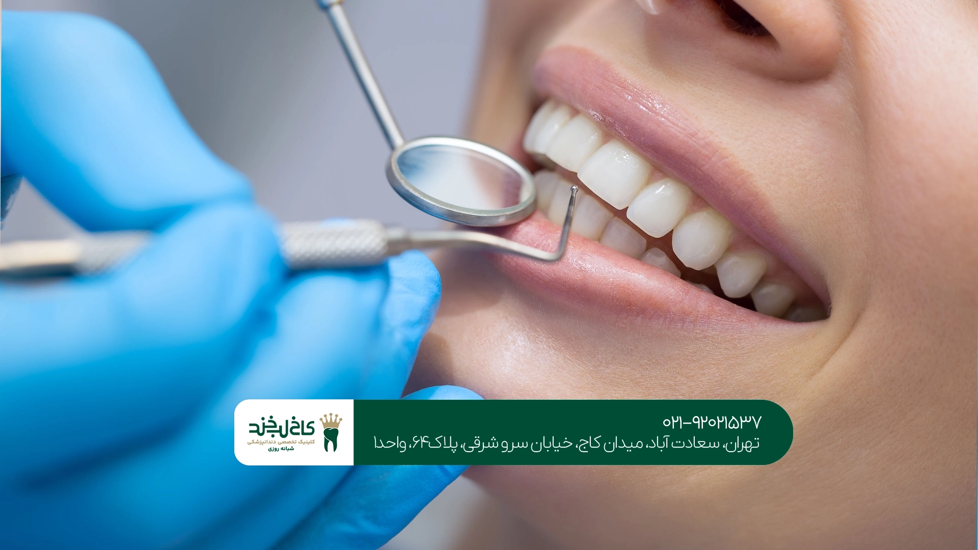 جرمگیری و بلیچینگ دندان در تهران جرمگیری و بلیچینگ دندان در تهران