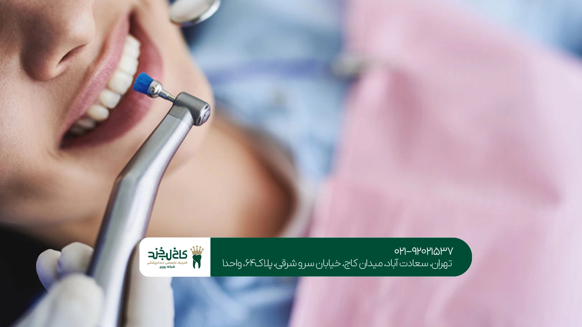 بهترین مرکز جرمگیری و بلیچینگ دندان بهترین مرکز جرمگیری و بلیچینگ دندان