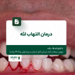 درمان التهاب لثه