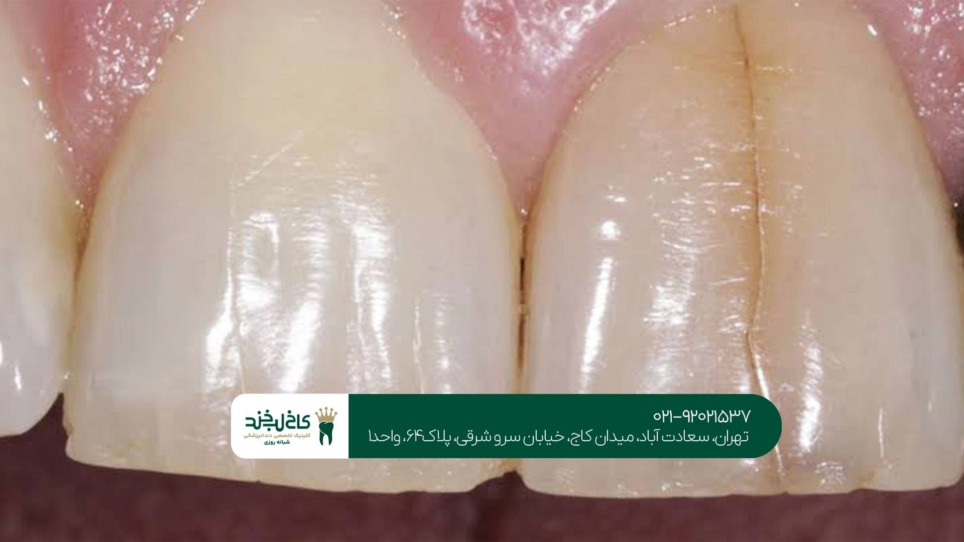 مزایای مراجعه به کلینیک دندانپزشکی بزرگ تهران