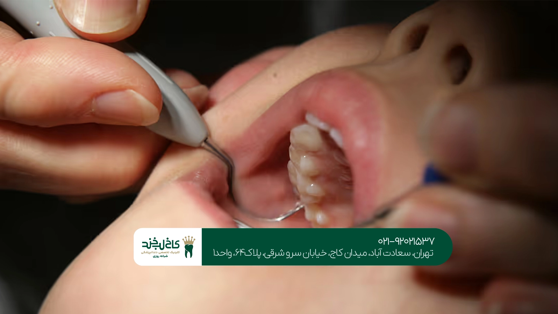 شرایط درمان دندان اقساطی در تهران شرایط درمان دندان اقساطی در تهران