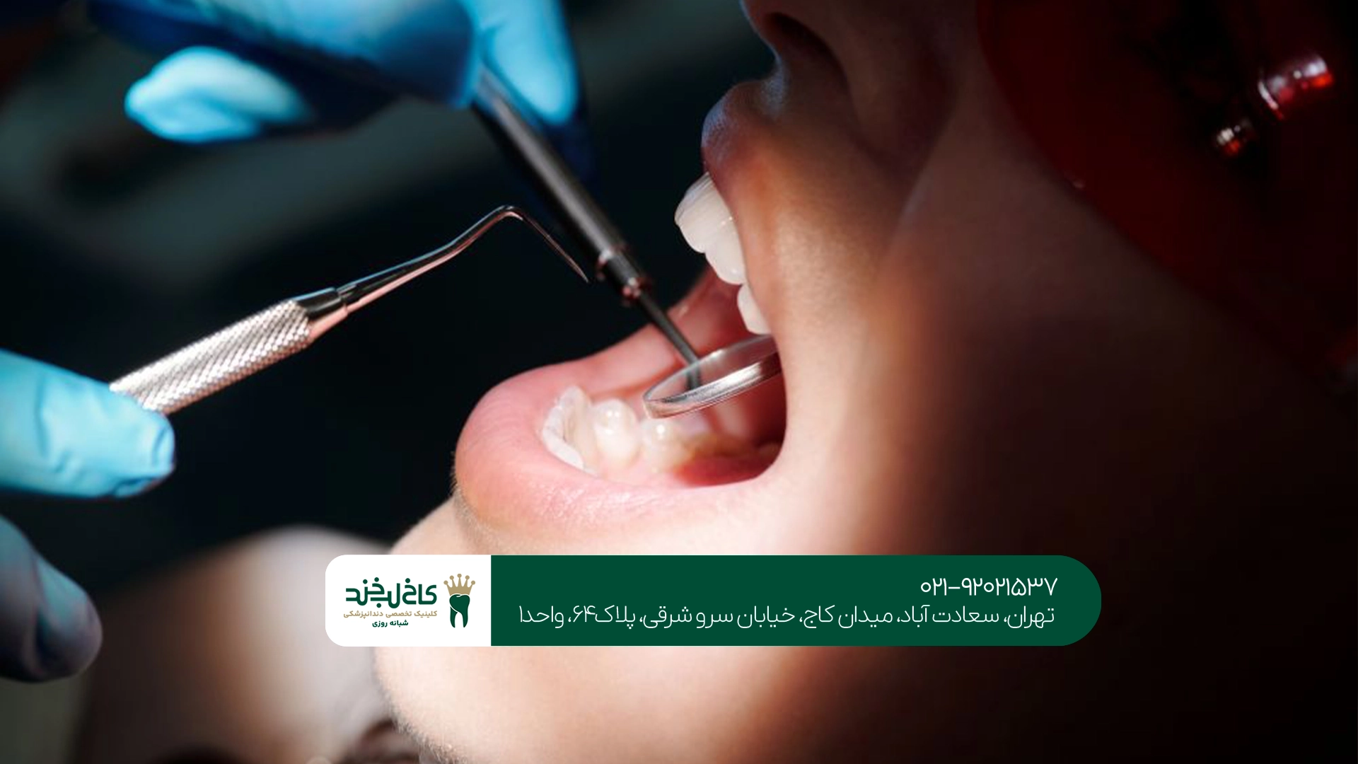 هزینه درمان دندان اقساطی در تهران هزینه درمان دندان اقساطی در تهران