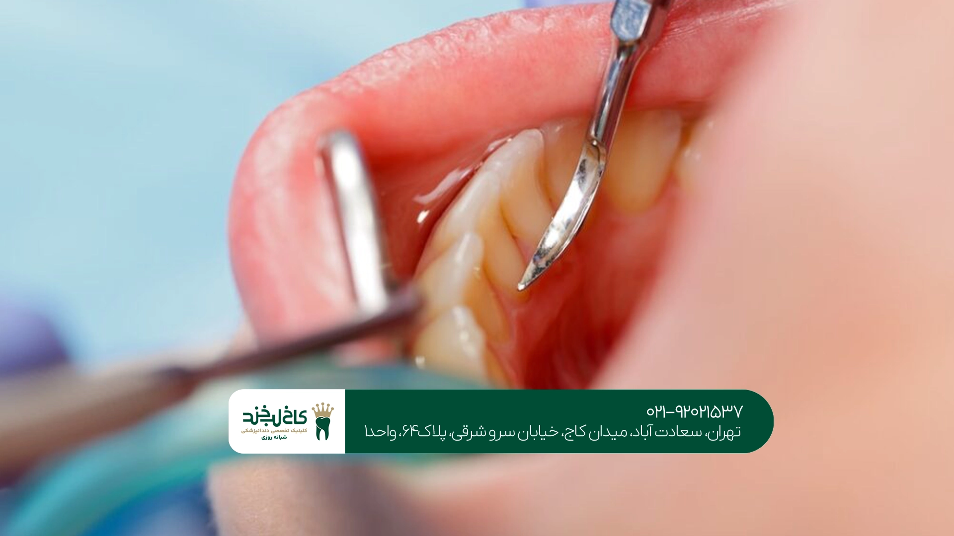 بهترین دندانپزشکی اقساطی در تهران بهترین دندانپزشکی اقساطی در تهران