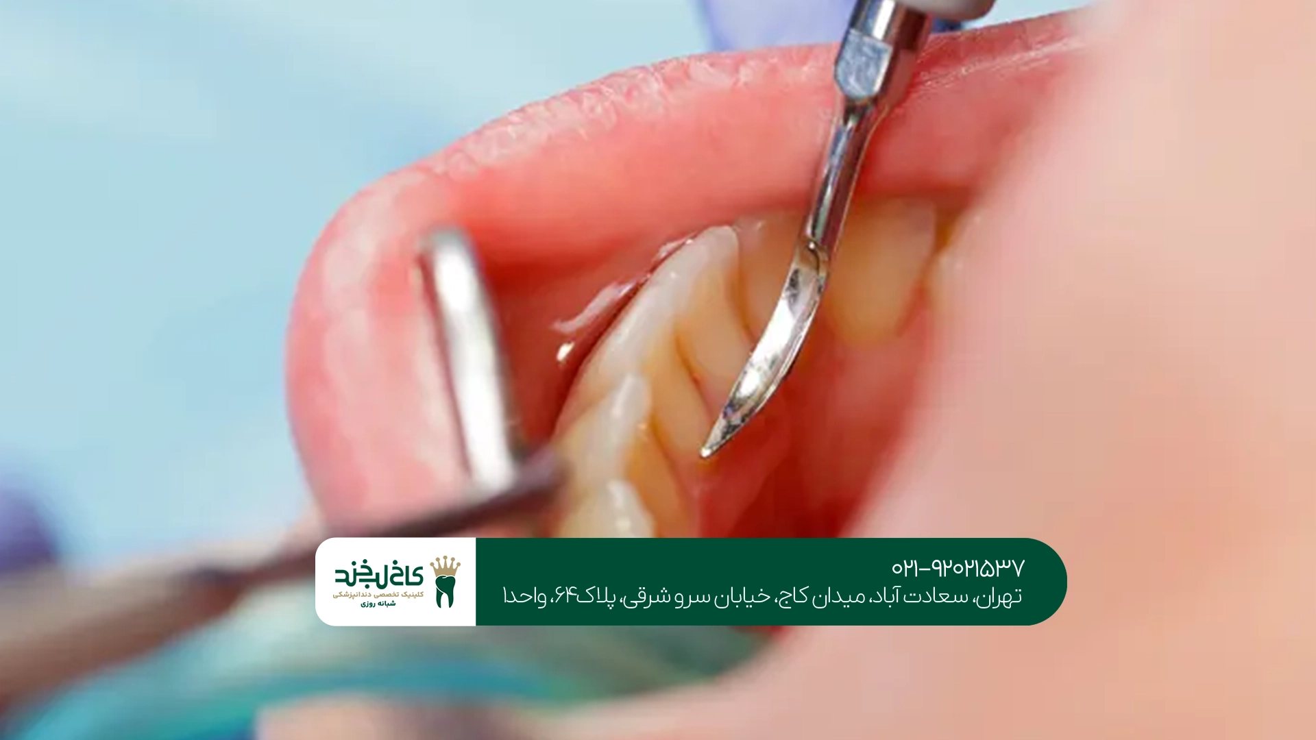 بهترین مرکز درمان دندان بدون درد