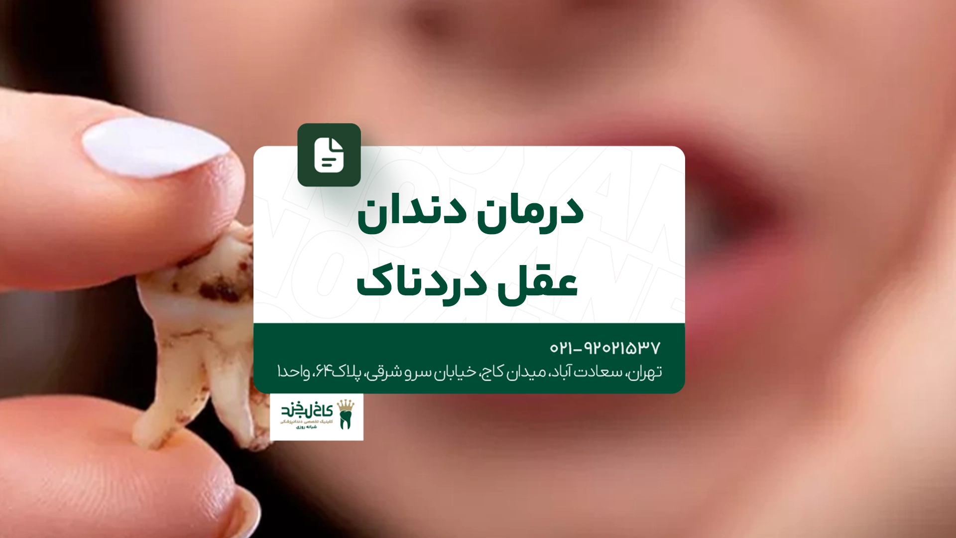 درمان دندان عقل دردناک