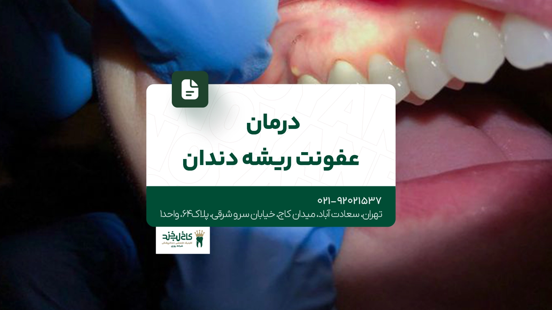درمان عفونت ریشه دندان درمان عفونت ریشه دندان