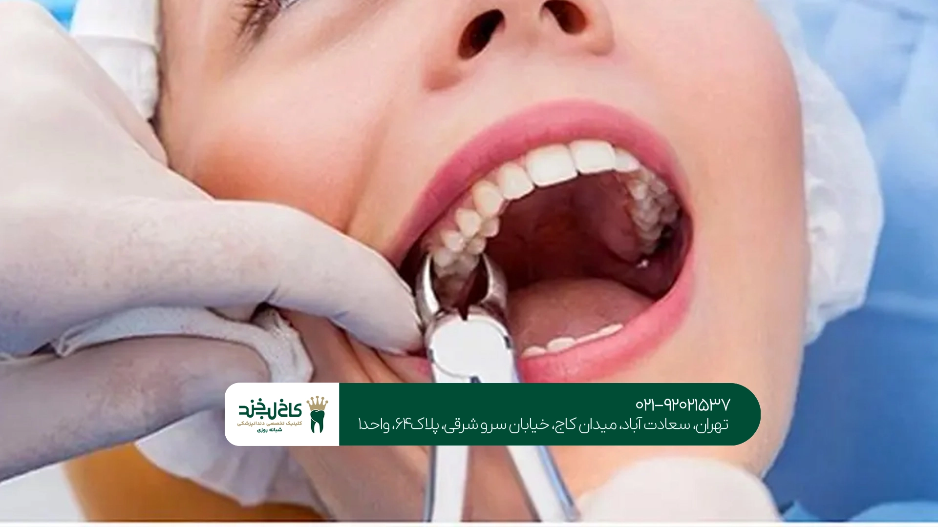 دندانپزشکی عمومی تهران