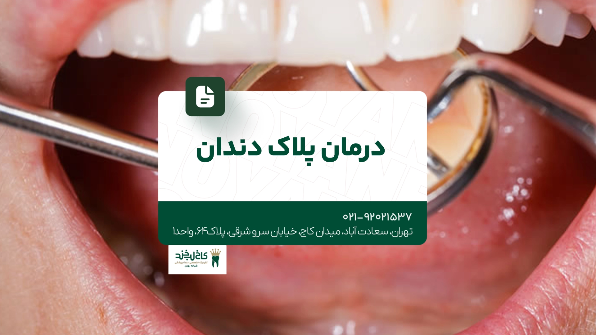 درمان پلاک دندان درمان پلاک دندان