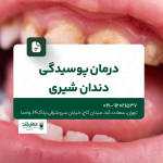 درمان پوسیدگی دندان شیری