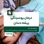 درمان پوسیدگی ریشه دندان