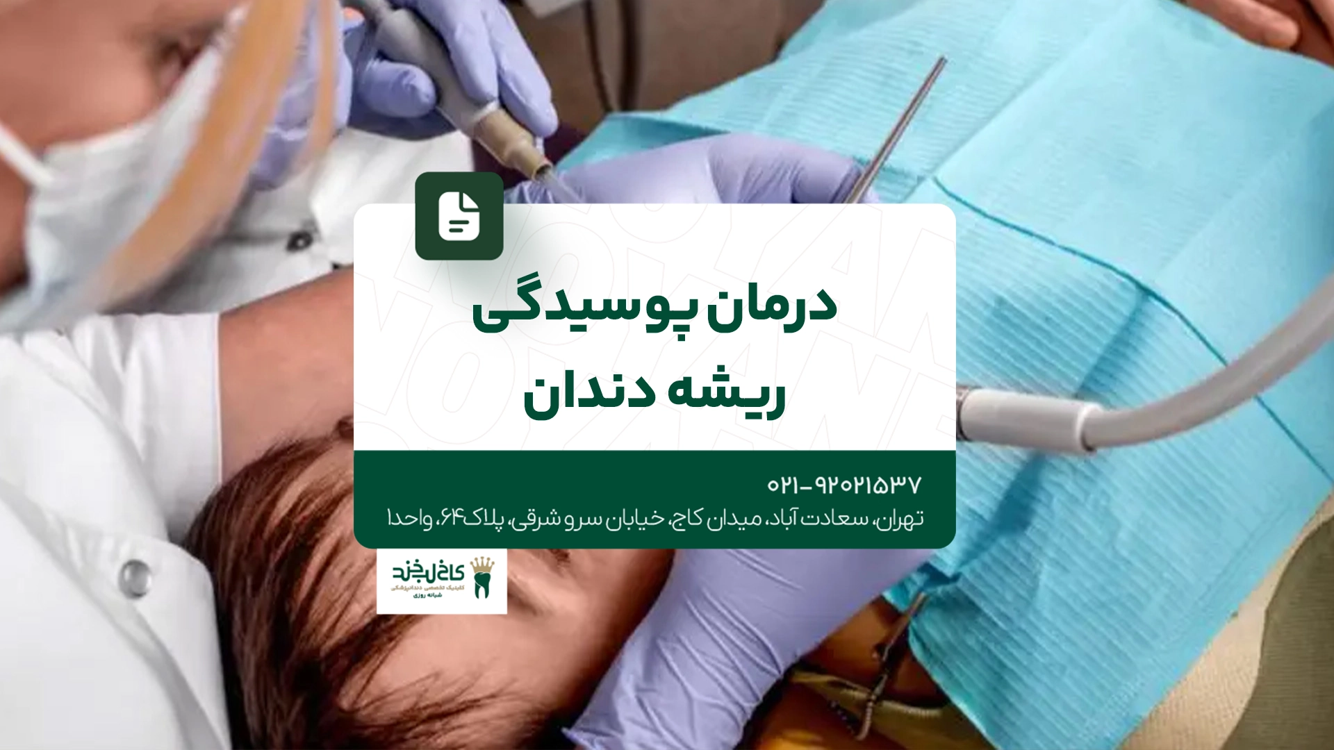 درمان پوسیدگی ریشه دندان درمان پوسیدگی ریشه دندان